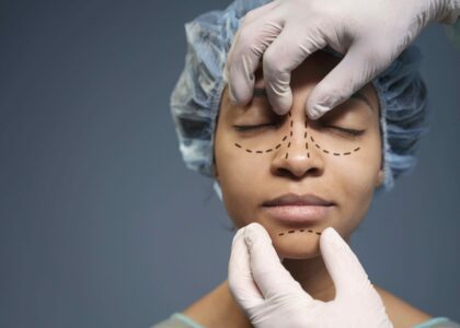 Oculoplasty Surgery