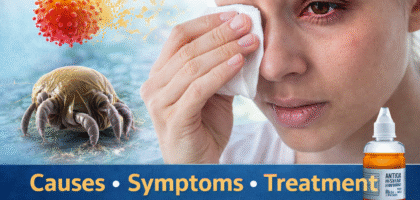 Woman suffering from eye allergy with red watery eyes showing symptoms like itching and redness along with treatment eye drops.