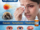 Woman suffering from eye allergy with red watery eyes showing symptoms like itching and redness along with treatment eye drops.